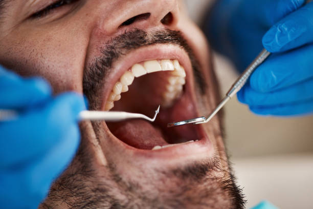 Best Dental Fillings (Composite and Amalgam)  in Bethany, OK